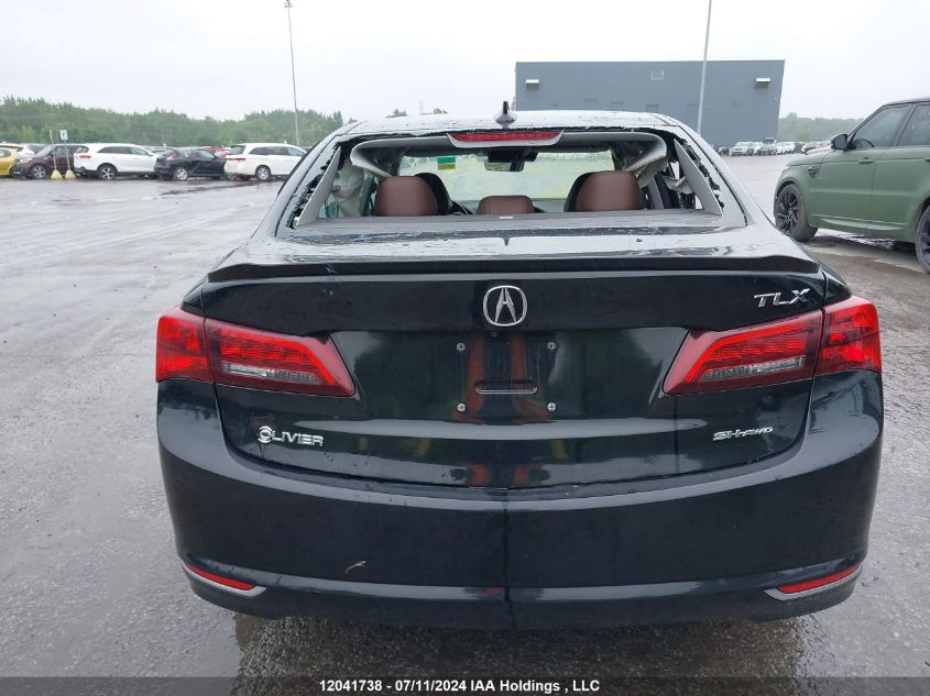 2017 Acura Tlx Tech VIN: 19UUB3F5XHA801042 Lot: 12041738