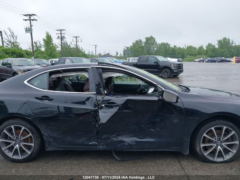2017 Acura Tlx Tech VIN: 19UUB3F5XHA801042 Lot: 12041738