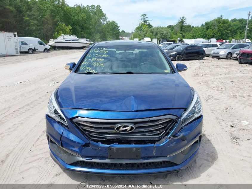 2016 Hyundai Sonata Sport/Limited VIN: 5NPE34AF7GH380460 Lot: 12041929