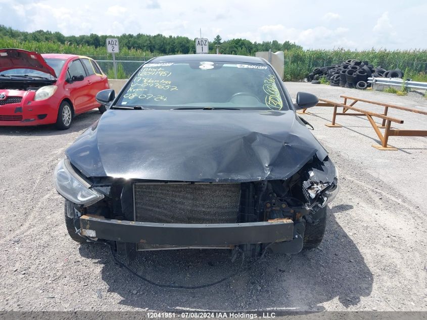 2017 Hyundai Elantra VIN: 5NPD74LF7HH047657 Lot: 12041951