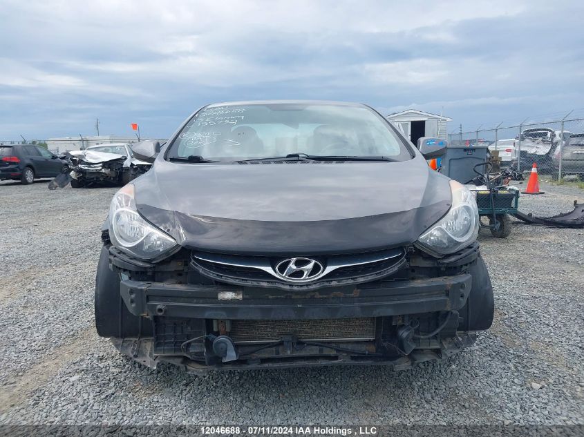 2013 Hyundai Elantra Gl VIN: 5NPDH4AE3DH155792 Lot: 12046688