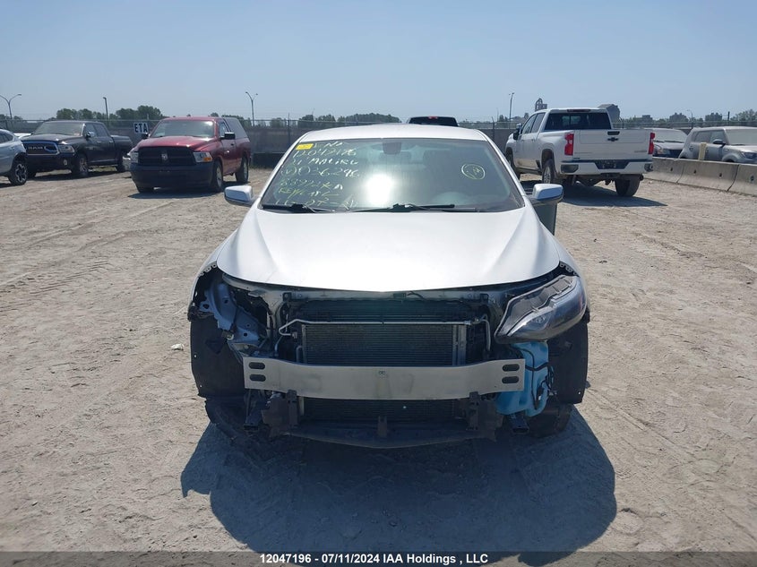 2021 Chevrolet Malibu VIN: 1G1ZD5ST7MF036246 Lot: 12047196