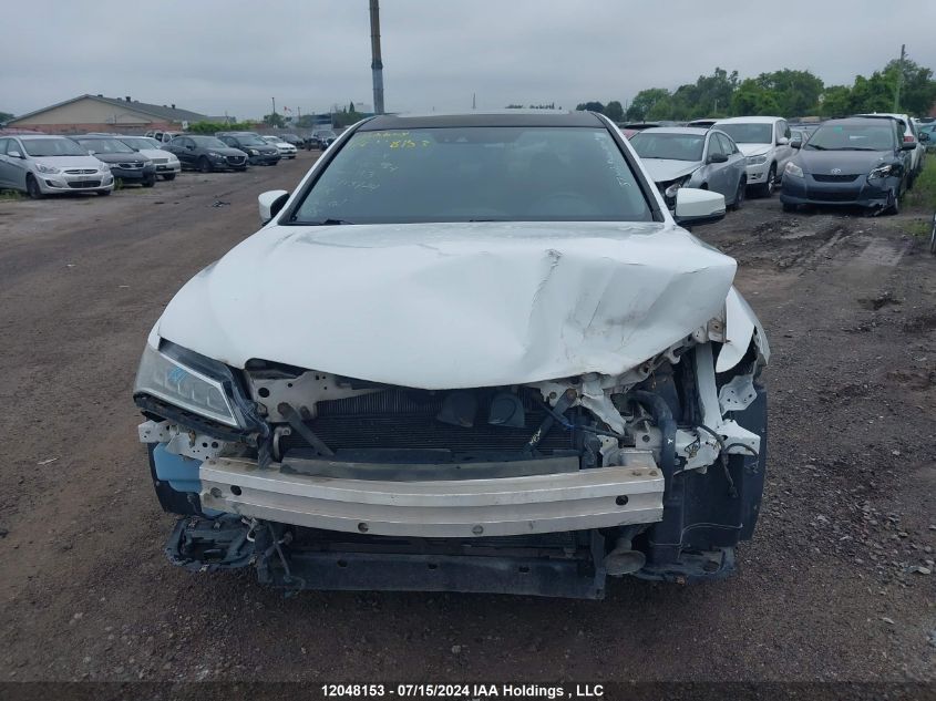 2016 Acura Tlx VIN: 19UUB3F52GA800384 Lot: 12048153