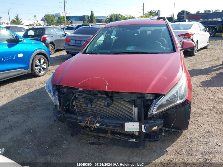 2017 Hyundai Sonata Se VIN: 5NPE24AF2HH524663 Lot: 12049360