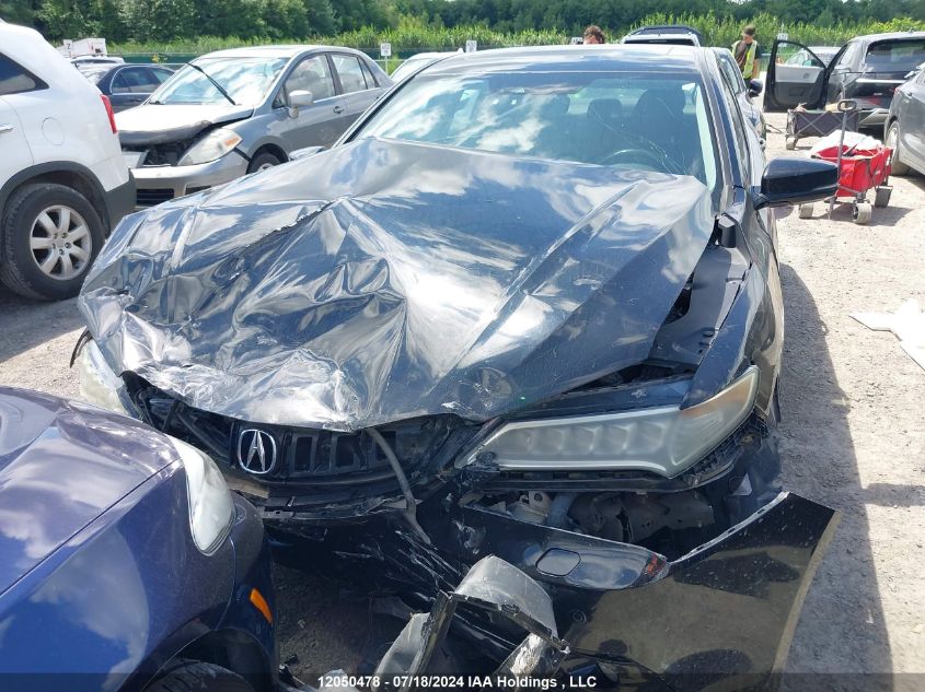 19UUB3F78GA800732 2016 Acura Tlx