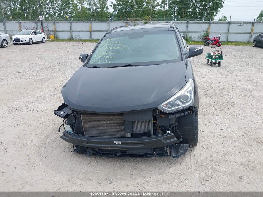 2017 Hyundai Santa Fe VIN: 5XYZUDLA5HG454421 Lot: 12051182