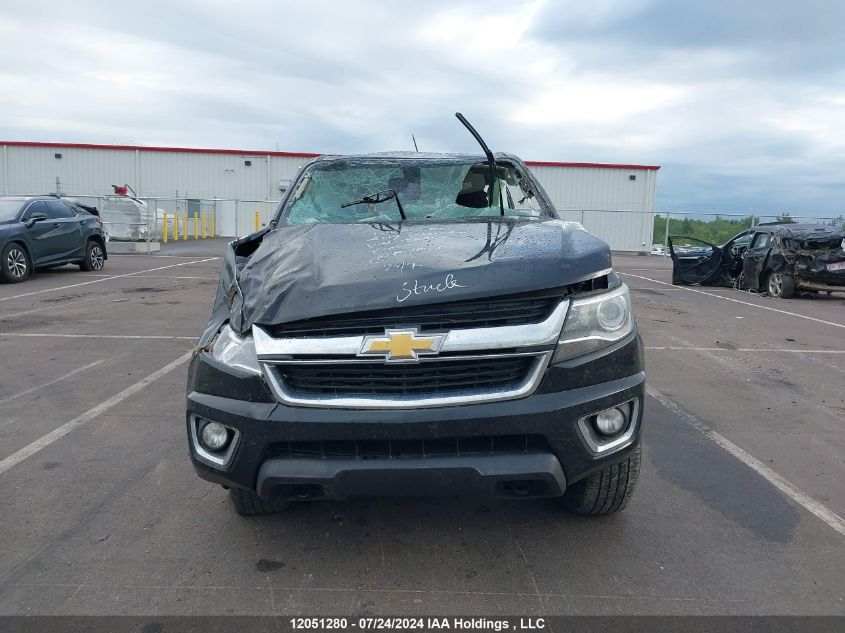 2017 Chevrolet Colorado VIN: 1GCGTCEN4H1186966 Lot: 12051280