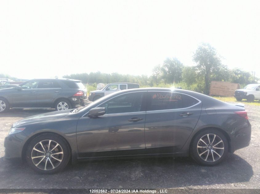 2015 Acura Tlx Tech VIN: 19UUB3F51FA800083 Lot: 12052562