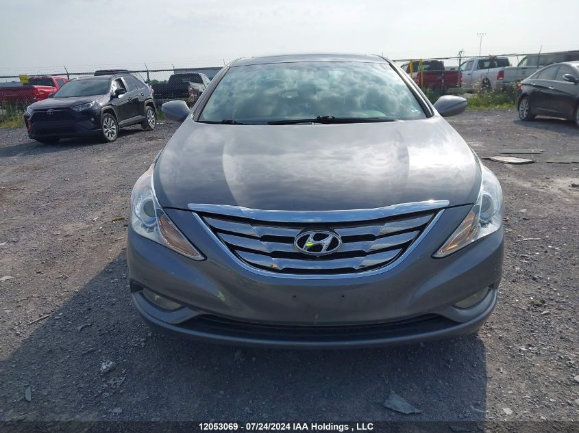 2013 Hyundai Sonata Gls VIN: 5NPEB4AC4DH796843 Lot: 12053069