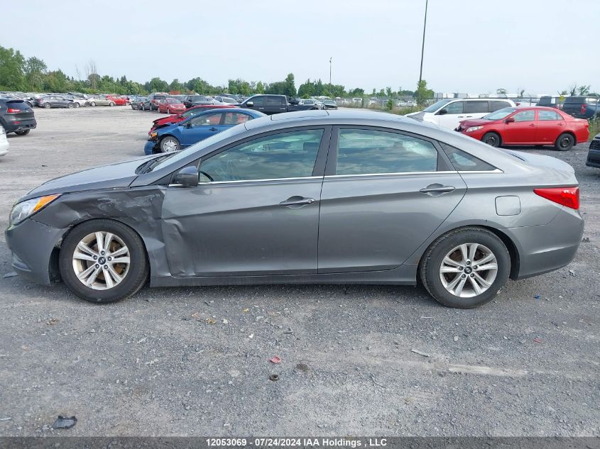 2013 Hyundai Sonata Gls VIN: 5NPEB4AC4DH796843 Lot: 12053069