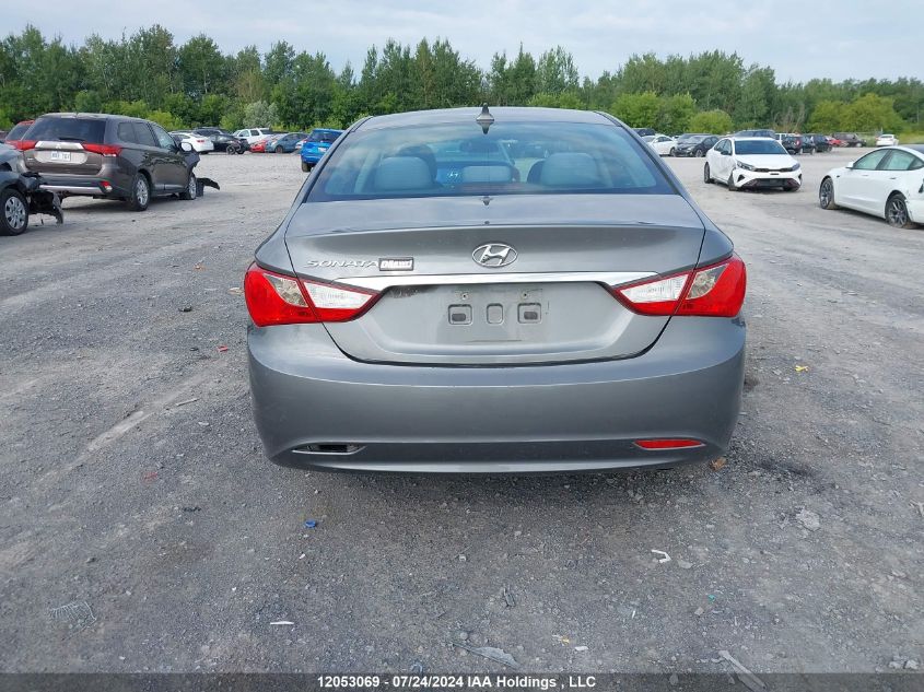 2013 Hyundai Sonata Gls VIN: 5NPEB4AC4DH796843 Lot: 12053069