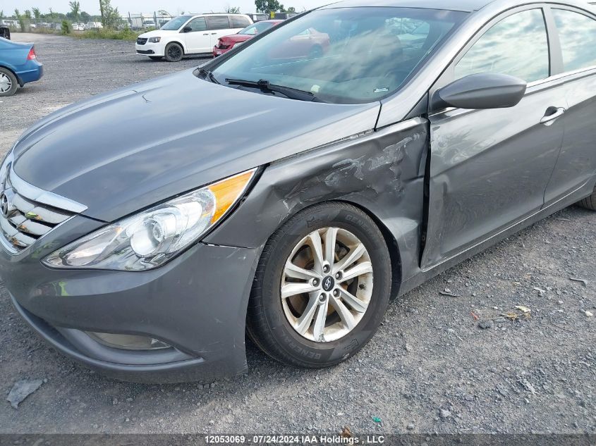 2013 Hyundai Sonata Gls VIN: 5NPEB4AC4DH796843 Lot: 12053069