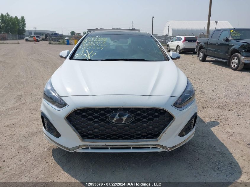 5NPE34AB2JH651607 2018 Hyundai Sonata Sport/Limited/Sel