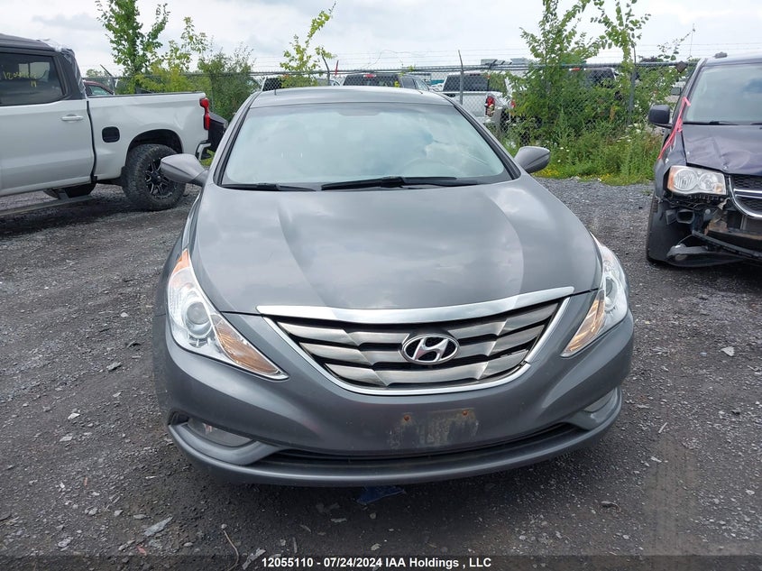 2011 Hyundai Sonata Gls VIN: 5NPEB4AC9BH276182 Lot: 12055110