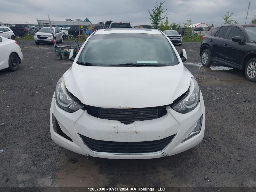 2016 Hyundai Elantra Sport Appearance VIN: KMHDH4AE7GU556378 Lot: 12057030