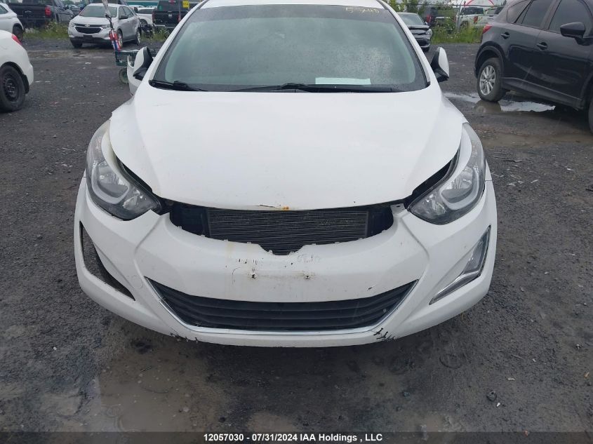 2016 Hyundai Elantra Sport Appearance VIN: KMHDH4AE7GU556378 Lot: 12057030