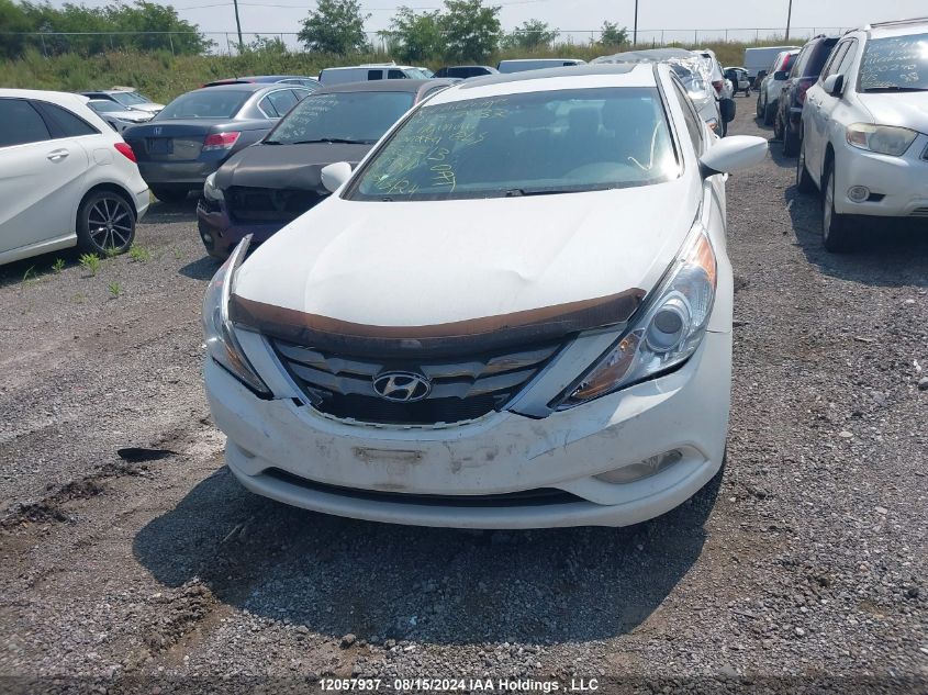 2013 Hyundai Sonata Gls VIN: 5NPEB4ACXDH563713 Lot: 12057937