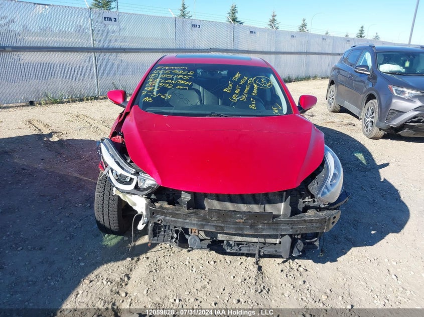 2014 Hyundai Elantra Limited VIN: KMHDH4AH1EU185175 Lot: 12059828