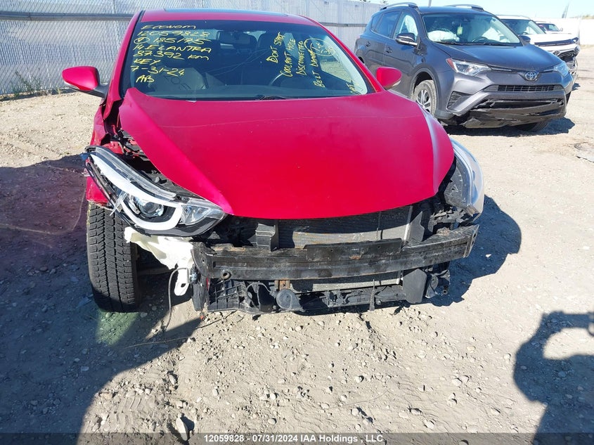 2014 Hyundai Elantra Limited VIN: KMHDH4AH1EU185175 Lot: 12059828