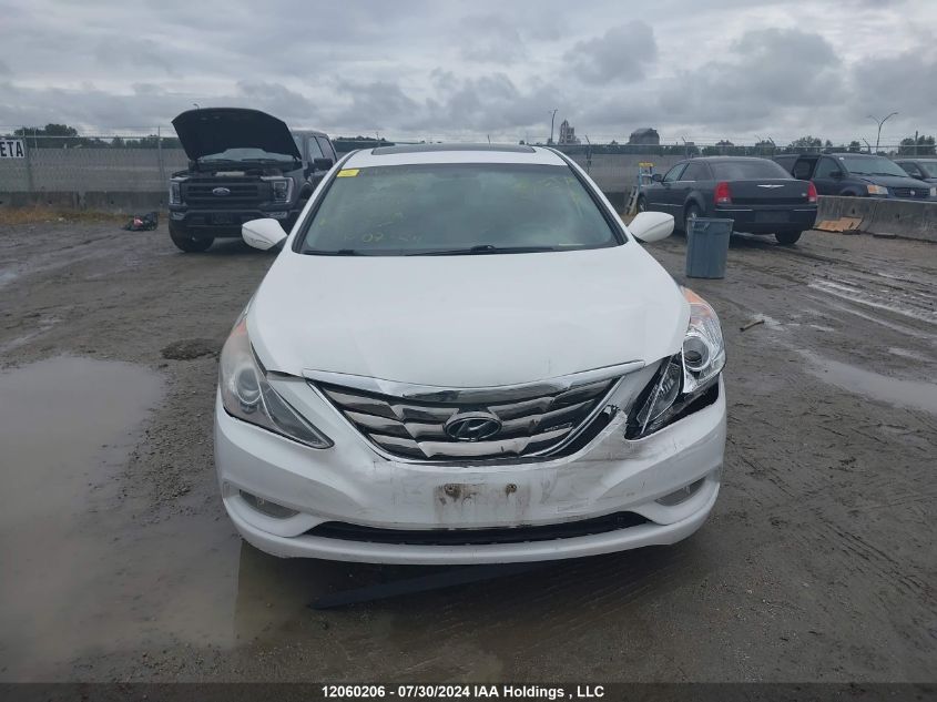 2013 Hyundai Sonata Se/Limited VIN: 5NPEC4ACXDH677918 Lot: 12060206