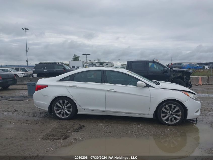 2013 Hyundai Sonata Se/Limited VIN: 5NPEC4ACXDH677918 Lot: 12060206