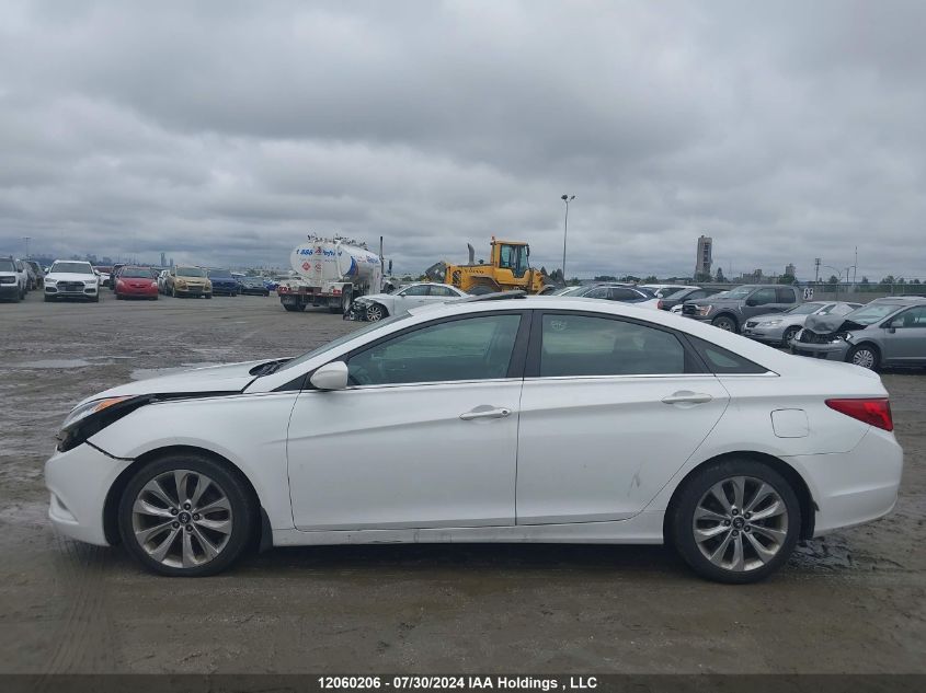 2013 Hyundai Sonata Se/Limited VIN: 5NPEC4ACXDH677918 Lot: 12060206