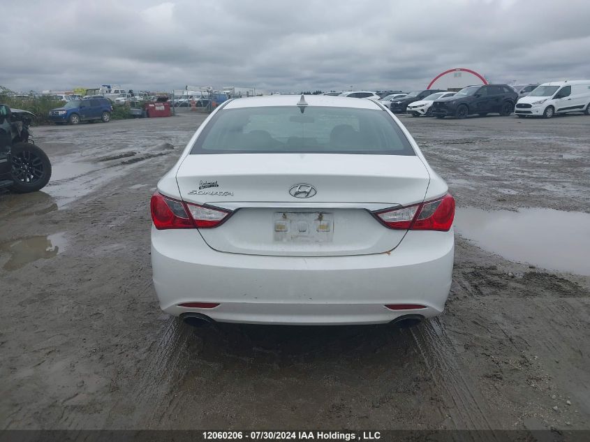 2013 Hyundai Sonata Se/Limited VIN: 5NPEC4ACXDH677918 Lot: 12060206