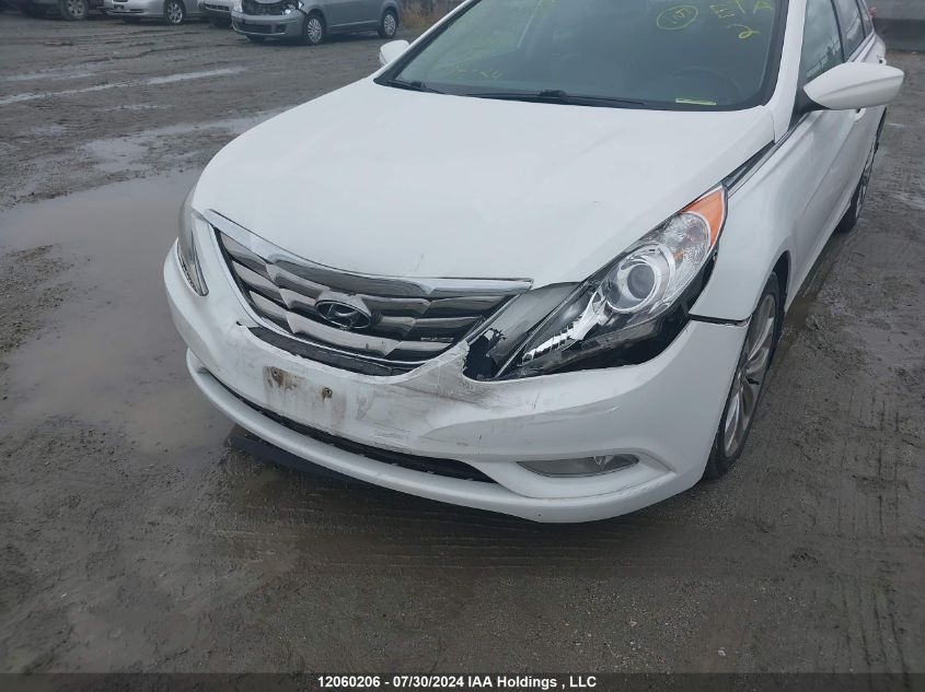 2013 Hyundai Sonata Se/Limited VIN: 5NPEC4ACXDH677918 Lot: 12060206