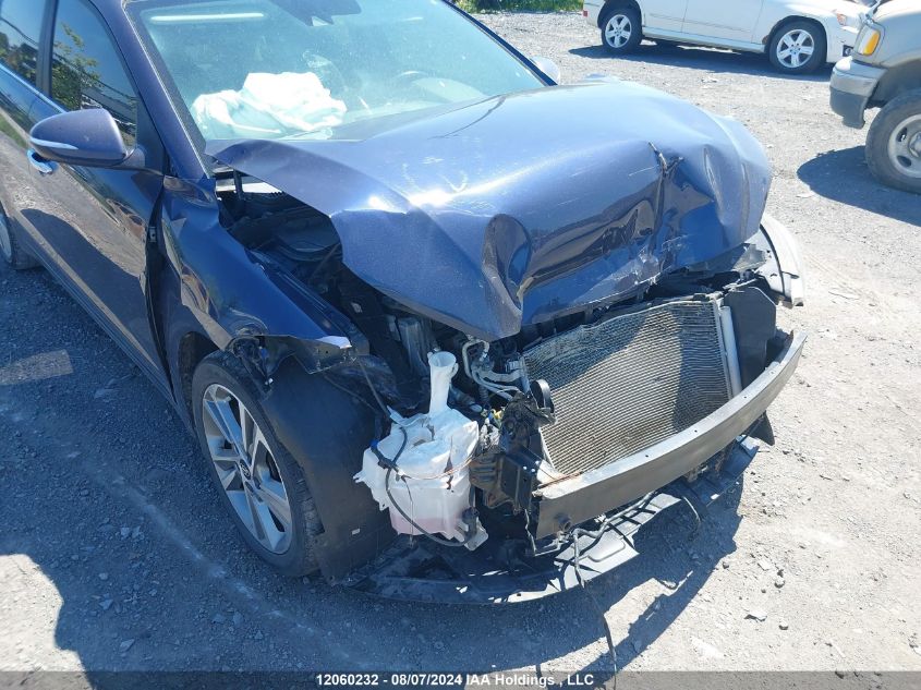 2018 Hyundai Elantra Sel/Value/Limited VIN: KMHD84LF8JU509423 Lot: 12060232