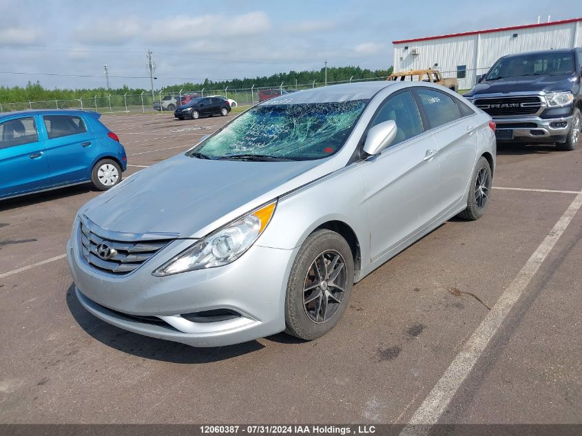 2013 Hyundai Sonata Gls VIN: 5NPEB4AC7DH782662 Lot: 12060387