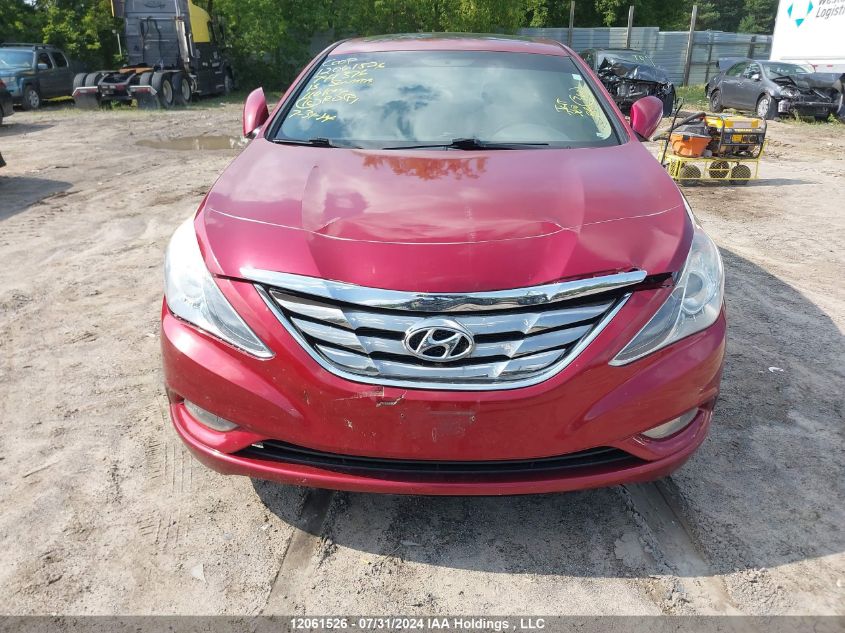 2013 Hyundai Sonata Gls VIN: 5NPEB4ACXDH741376 Lot: 12061526