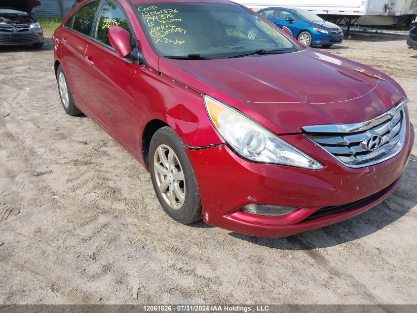 2013 Hyundai Sonata Gls VIN: 5NPEB4ACXDH741376 Lot: 12061526