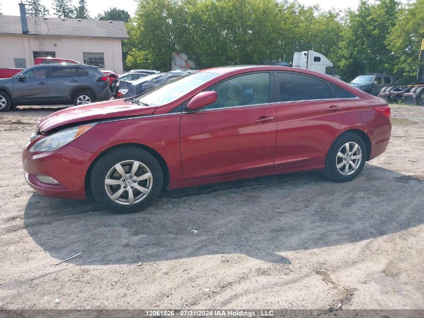 2013 Hyundai Sonata Gls VIN: 5NPEB4ACXDH741376 Lot: 12061526