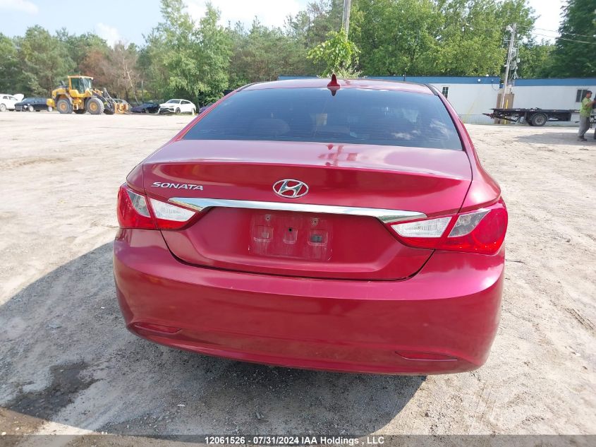 2013 Hyundai Sonata Gls VIN: 5NPEB4ACXDH741376 Lot: 12061526