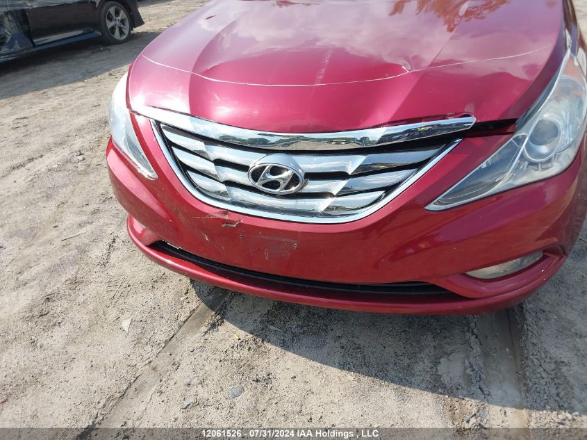 2013 Hyundai Sonata Gls VIN: 5NPEB4ACXDH741376 Lot: 12061526