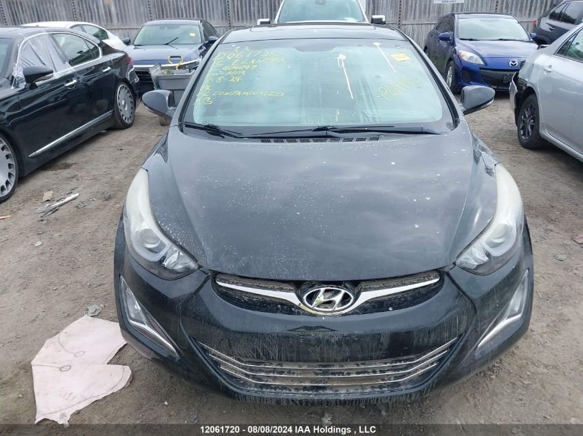 2015 Hyundai Elantra Se/Sport/Limited VIN: KMHDH4AH2FU404047 Lot: 12061720