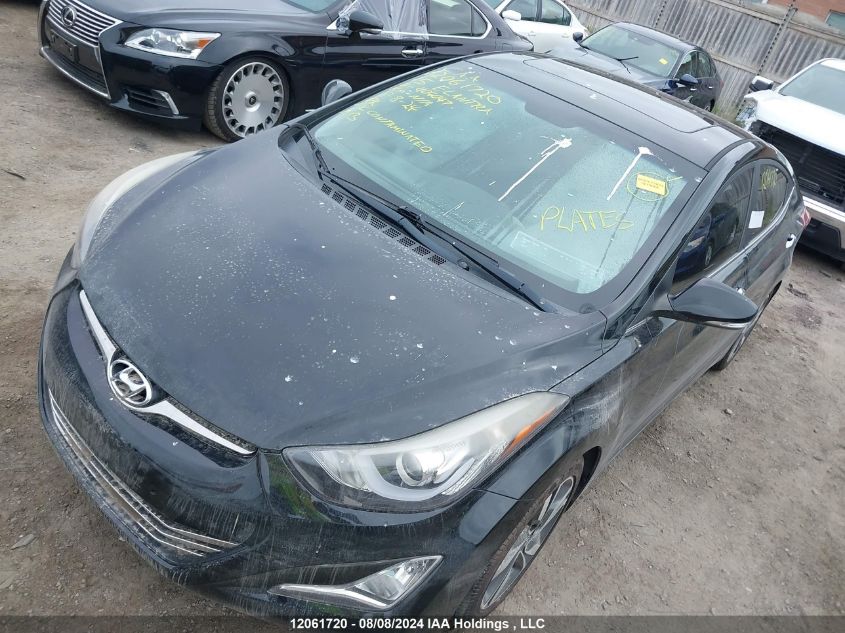 2015 Hyundai Elantra Se/Sport/Limited VIN: KMHDH4AH2FU404047 Lot: 12061720