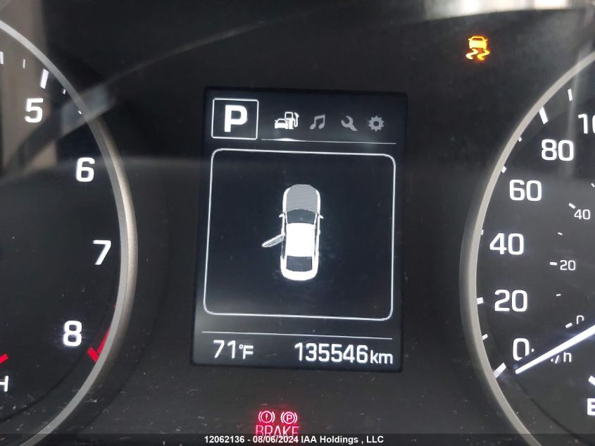 2018 Hyundai Elantra Sel/Value/Limited VIN: KMHD84LF9JU674865 Lot: 12062136