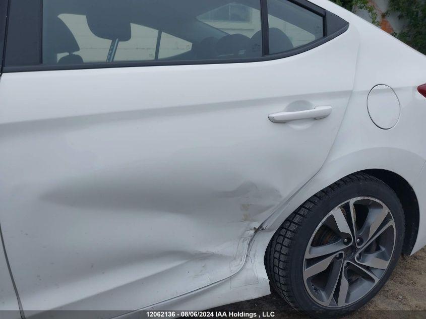 2018 Hyundai Elantra Sel/Value/Limited VIN: KMHD84LF9JU674865 Lot: 12062136