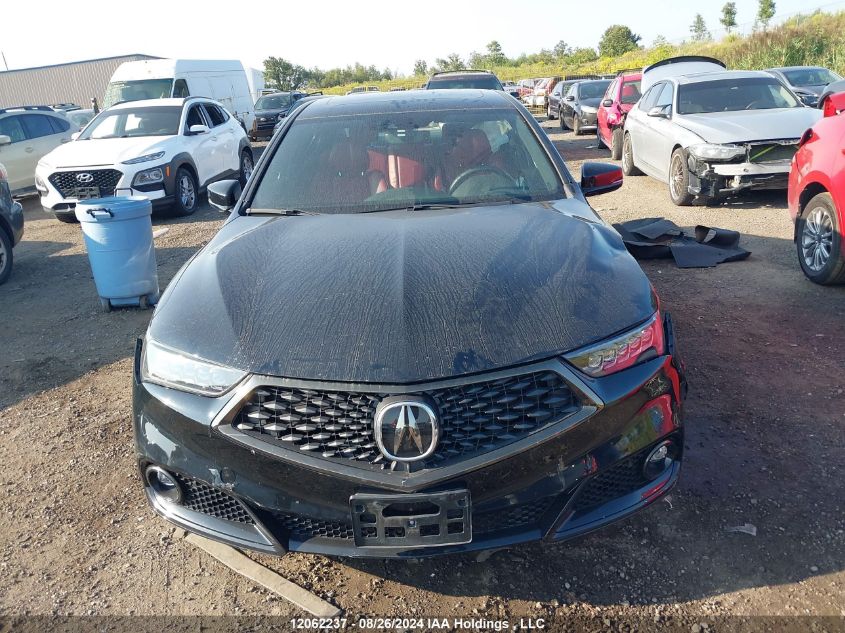 19UUB1F65JA801162 2018 Acura Tlx Tech/Tech R