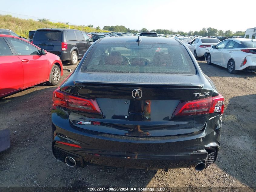 19UUB1F65JA801162 2018 Acura Tlx Tech/Tech R