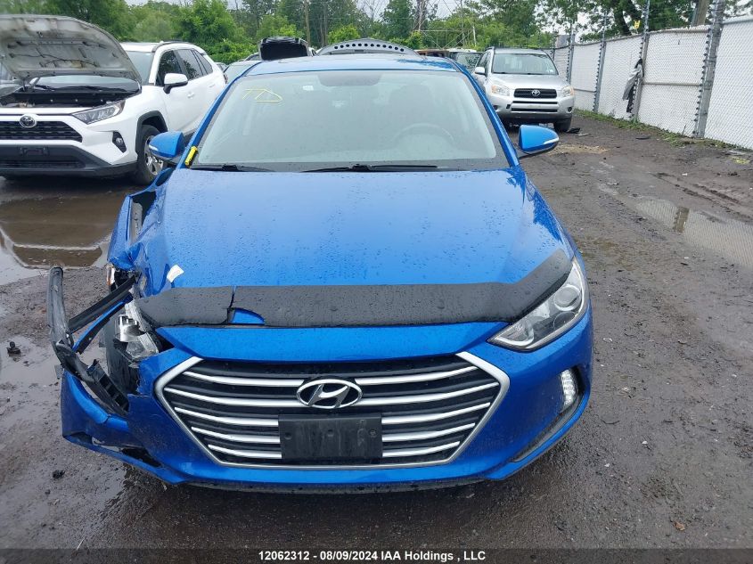 2017 Hyundai Elantra Se/Value/Limited VIN: KMHD84LF7HU099143 Lot: 12062312