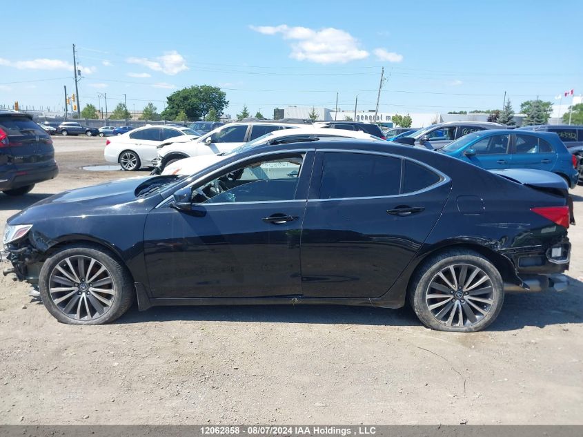 2019 Acura Tlx Technology VIN: 19UUB3F54KA801027 Lot: 12062858