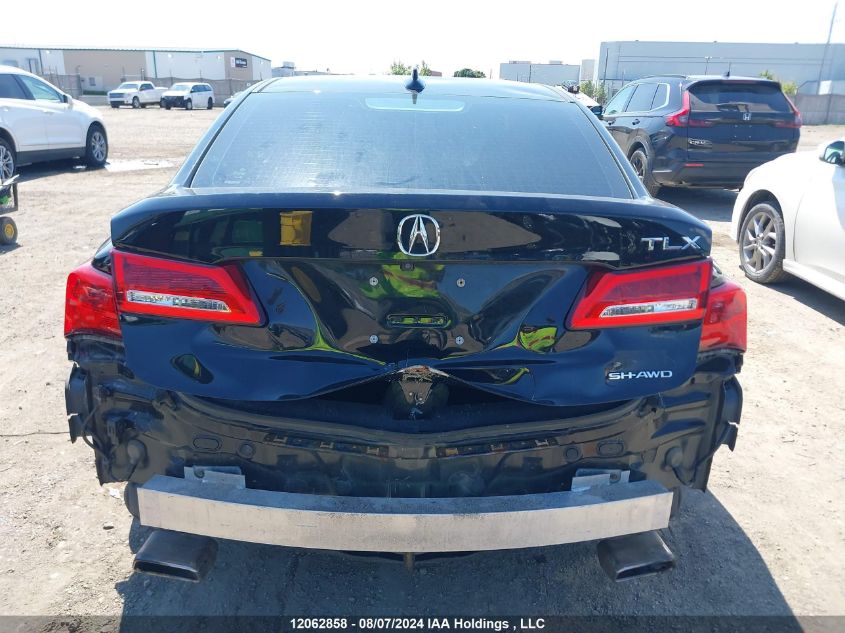 2019 Acura Tlx Technology VIN: 19UUB3F54KA801027 Lot: 12062858