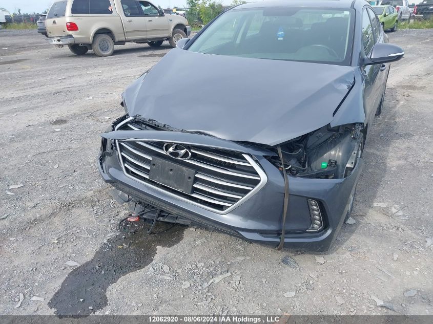 2017 Hyundai Elantra Gls VIN: KMHD84LF4HU210103 Lot: 12062920