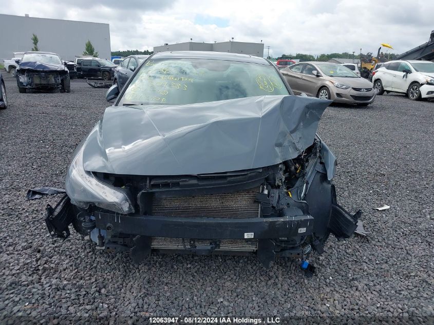 2022 Hyundai Elantra Ultimate Ivt VIN: KMHLN4AG8NU304383 Lot: 12063947