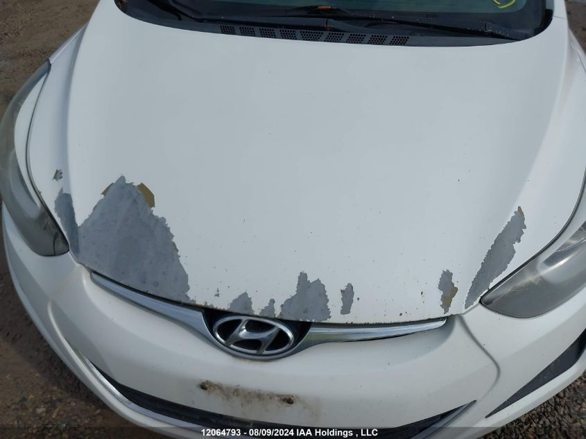 2016 Hyundai Elantra VIN: 5NPDH4AEXGH713559 Lot: 12064793