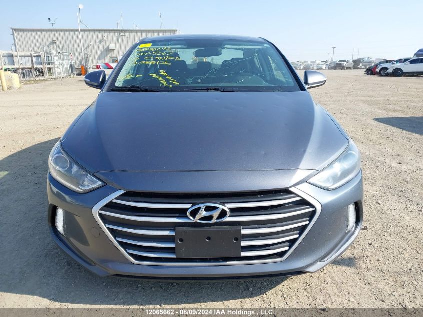 2018 Hyundai Elantra Sel/Value/Limited VIN: KMHD84LF9JU638125 Lot: 12065662