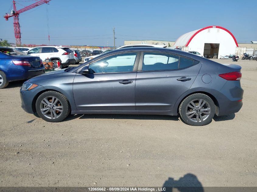 2018 Hyundai Elantra Sel/Value/Limited VIN: KMHD84LF9JU638125 Lot: 12065662