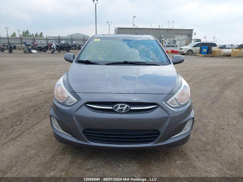 2017 Hyundai Accent Se VIN: KMHCT4AE3HU182993 Lot: 12065940